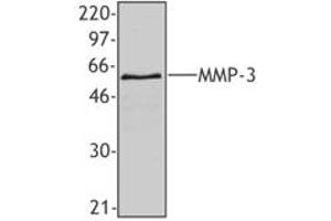 Image no. 1 for anti-Matrix Metallopeptidase 3 (Stromelysin 1, Progelatinase) (MMP3) antibody (ABIN205498) (MMP3 anticorps)