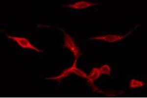 ABIN6275942 staining COLO205 by IF/ICC.