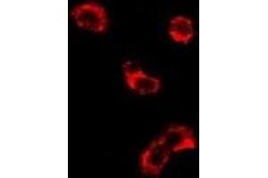 Immunofluorescent analysis of EEF1D staining in U2OS cells.