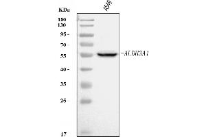 Western blot analysis of ALDH3A1 using anti-ALDH3A1 antibody (ABIN7601680).