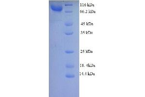 SDS-PAGE (SDS) image for Frizzled-Related Protein (FRZB) (AA 39-760) protein (GST tag) (ABIN5711497)