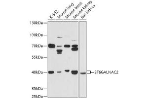 Western blot analysis of extracts of various cell lines, using ST6G antibody (ABIN7270579) at 1:1000 dilution. (ST6GALNAC2 anticorps  (AA 30-200))