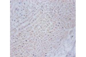 Immunohistochemistry of paraffin-embedded human umbilical cord tissue using ABIN7149009 at dilution of 1:100 (CSRP2 anticorps  (AA 2-193))