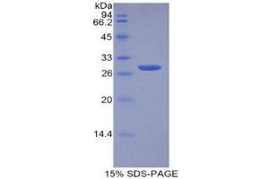 SDS-PAGE (SDS) image for Tumor Protein, Translationally-Controlled 1 (TPT1) (AA 1-172) protein (His tag) (ABIN1081084) (TPT1 Protein (AA 1-172) (His tag))