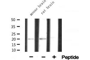 Western blot analysis of extracts of various tissue ,using RPL15 antibody (RPL15 anticorps  (C-Term))
