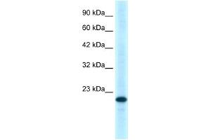 WB Suggested Anti-TNFRSF18 Antibody Titration:  0. (TNFRSF18 anticorps  (C-Term))
