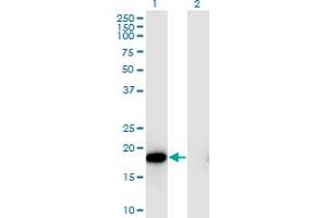 Western Blot analysis of HSPB6 expression in transfected 293T cell line by HSPB6 monoclonal antibody (M03), clone 6A4. (HSPB6 anticorps  (AA 1-160))