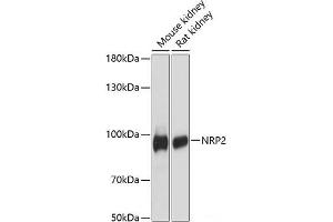 Western blot analysis of extracts of various cell lines using NRP2 Polyclonal Antibody at dilution of 1:3000. (NRP2 anticorps)