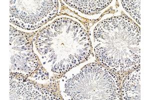 ABIN7096183 and ABIN7100245 at 1/100 staining rat testis tissue by IHC-P. (FAM181A anticorps)