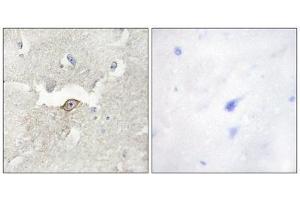 Immunohistochemistry (IHC) image for anti-Lemur tyrosine Kinase 2 (LMTK2) (Internal Region) antibody (ABIN1849762) (LMTK2 anticorps  (Internal Region))