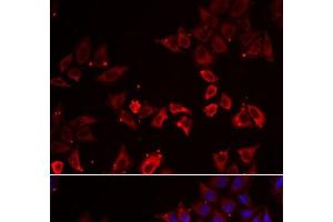 Immunofluorescence analysis of A549 cells using LIMS1 Polyclonal Antibody