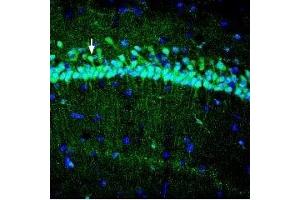 Expression of Zinc transporter ZIP3 in rat hippocampus - Immunohistochemical staining of perfusion-fixed frozen rat brain sections using Anti-ZIP3 (SLC39A3) Antibody (ABIN7043724, ABIN7045346 and ABIN7045347), (1:400), followed by goat-anti-rabbit-AlexaFluor-488 antibody.