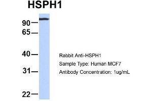 Host: Rabbit  Target Name: HSPH1  Sample Tissue: Human MCF7  Antibody Dilution: 1. (HSPH1 anticorps  (Middle Region))