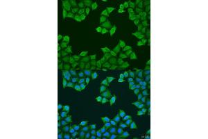 Immunofluorescence analysis of U2OS cells using J antibody (ABIN1678787, ABIN3018048, ABIN3018049 and ABIN6220343) at dilution of 1:100.