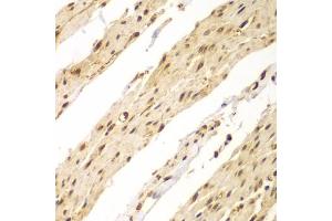 Immunohistochemistry of paraffin-embedded human colon using CDX1 antibody (ABIN2561793) at dilution of 1:100 (40x lens). (CDX1 anticorps)