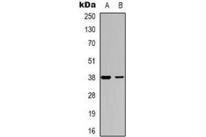 Western blot analysis of DOK6 expression in SHSY5Y (A), COLO205 (B) whole cell lysates. (DOK6 anticorps)