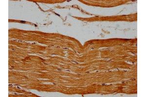 IHC image of ABIN7164973 diluted at 1:500 and staining in paraffin-embedded human skeletal muscle tissue performed on a Leica BondTM system.
