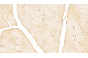 Detection of MSLN in Human Skeletal muscle Tissue using Monoclonal Antibody to Mesothelin (MSLN) (Mesothelin anticorps  (AA 296-606))