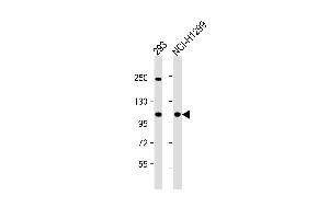 All lanes : Anti-CTDP1 Antibody (N-term) at 1:1000 dilution Lane 1: 293 whole cell lysate Lane 2: NCI- whole cell lysate Lysates/proteins at 20 μg per lane. (CTDP1 anticorps  (N-Term))