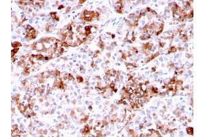 Formalin-fixed, paraffin-embedded human Pituitary stained with Prolactin Mouse Monoclonal Antibody (PRL/2644).