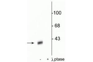 Western blot of rat striatal lysate showing specific immunolabeling of the ~32 kDa DARPP-32 phosphorylated at Thr34 in the first lane (-). (DARPP32 anticorps  (pThr34))
