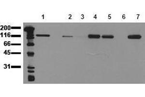 Western Blotting (WB) image for anti-Cadherin 1, Type 1, E-Cadherin (Epithelial) (CDH1) antibody (ABIN126734) (E-cadherin anticorps)