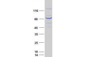 Validation with Western Blot