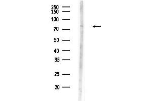 Western blot analysis of lysates from F10-LUC cells(UV,30 min treatment), using CNKSR3 Antibody at 1/1000 dilution.
