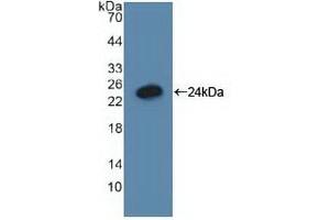 Detection of Recombinant GADD45a, Human using Polyclonal Antibody to Growth Arrest And DNA Damage Inducible Protein Alpha (GADD45a) (GADD45A anticorps  (AA 1-165))
