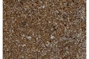 ABIN6278249 at 1/100 staining Mouse spleen tissue by IHC-P. (TRAM2 anticorps  (C-Term))