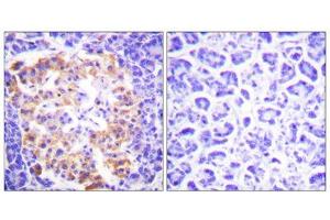 Immunohistochemistry analysis of paraffin-embedded human pancreas tissue, using Collagen Type III antibody. (COL3 anticorps  (N-Term))