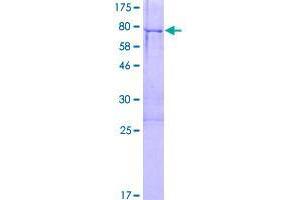 Image no. 1 for FEZ Family Zinc Finger 2 (FEZF2) (AA 1-459) protein (GST tag) (ABIN1353976)