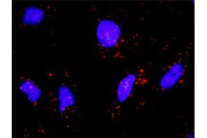 Proximity Ligation Analysis of protein-protein interactions between BIRC3 and IKBKB.