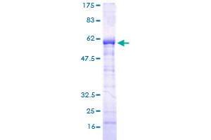 Image no. 1 for Suppressor of Ty 3 Homolog (SUPT3H) (AA 1-328) protein (GST tag) (ABIN1321908)