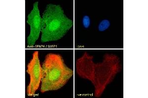 (ABIN334488) Immunofluorescence analysis of paraformaldehyde fixed U2OS cells, permeabilized with 0. (SENP6 anticorps  (Internal Region))