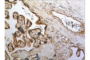 Immunohistochemistry (IHC) image for anti-Tumor Necrosis Factor (Ligand) Superfamily, Member 8 (TNFSF8) (AA 63-234) antibody (ABIN1983080)