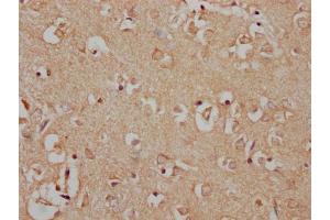 IHC image of nphHU diluted at 1:100 and staining in paraffin-embedded human brain tissue performed on a Leica BondTM system. (MAP3K7 anticorps  (AA 179-194))