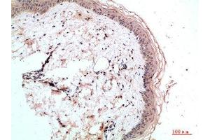 Immunohistochemical analysis of paraffin-embedded human-skin, antibody was diluted at 1:200