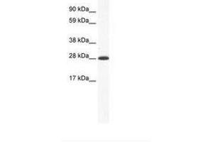 Image no. 1 for anti-Distal-Less Homeobox 4 (DLX4) (AA 57-106) antibody (ABIN202108) (DLX4 anticorps  (AA 57-106))