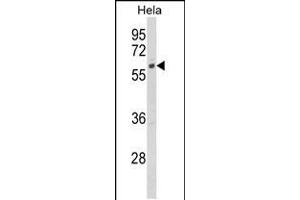 Western blot analysis of CYP7B1 Antibody in Hela cell line lysates (35ug/lane) (CYP7B1 anticorps  (AA 252-281))