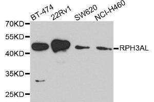 Western blot analysis of extract of various cells, using RPH3AL antibody. (RPH3AL anticorps)