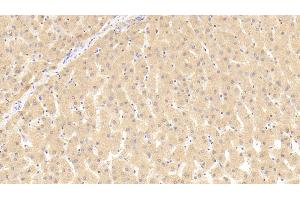 Detection of THRb in Human Liver Tissue using Polyclonal Antibody to Thyroid Hormone Receptor Beta (THRb) (THRB anticorps  (AA 239-457))