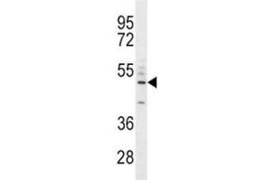 CD14 antibody western blot analysis in A549 lysate. (CD14 anticorps  (AA 292-322))