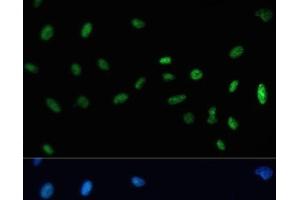 Immunofluorescence analysis of U-2 OS cells using SAFB Polyclonal Antibody at dilution of 1:100. (SAFB anticorps)