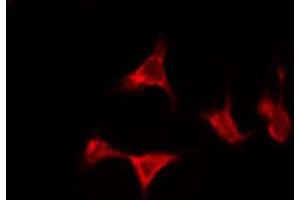ABIN6276166 staining Hela by IF/ICC. (OR5D13 anticorps  (C-Term))