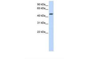 Image no. 1 for anti-Sulfotransferase Family, Cytosolic, 2B, Member 1 (SULT2B1) (AA 252-301) antibody (ABIN6738484)