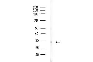 Western blot analysis of lysates from EC304 cells, using OR51M1 Antibody at 1/1000 dilution.
