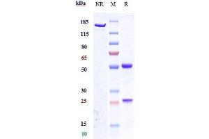 Anti-GPR20 Reference Antibody (DS-6157) on SDS-PAGE under reducing (R) condition.