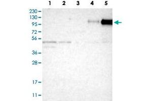 Western Blot analysis of Lane 1: RT-4 cell, Lane 2: U-251 MG sp cell, Lane 3: human plasma tissue (IgG/HSA depleted), Lane 4: human liver tissue and Lane 5: human tonsil tissue lysates with ITGB2 polyclonal antibody . (Integrin beta 2 anticorps)