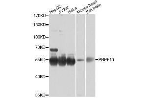 Western blot analysis of extracts of various cell lines, using PRPF19 antibody (ABIN6293423) at 1:1000 dilution. (PRP19 anticorps)